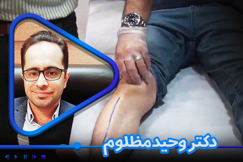 آکوپانکچر و الکتروآکوپانکچر در فیزیوتراپی