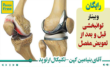توانبخشی قبل و بعد از تعویض مفصل