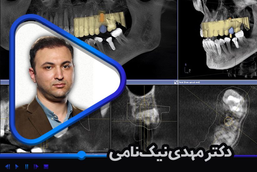 آشنایی با اصول تصویربرداری CBCT