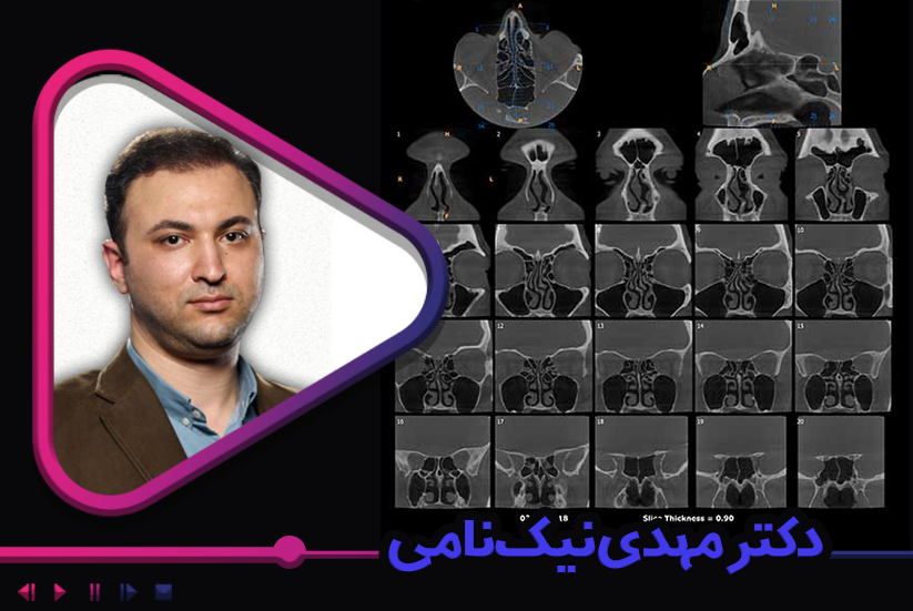 آشنایی با اصول تصویربرداری CBCT (ویژه کارشناسان رادیولوژی)
