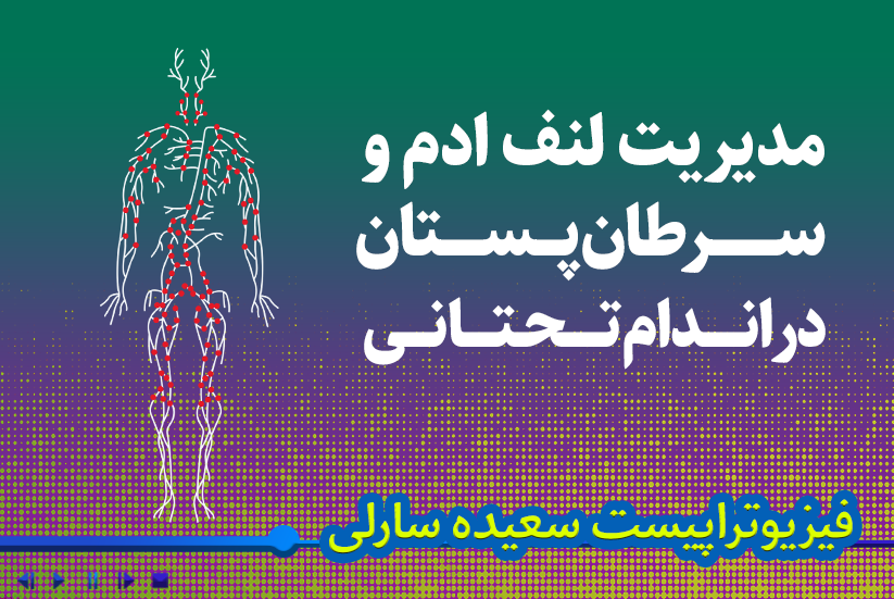 مدیریت لنف‌ادم و سرطان پستان در اندام تحتانی