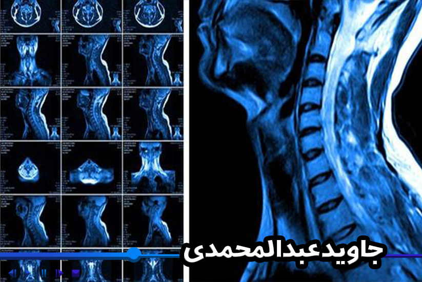 بهینه‌سازی تصاویر MRI 