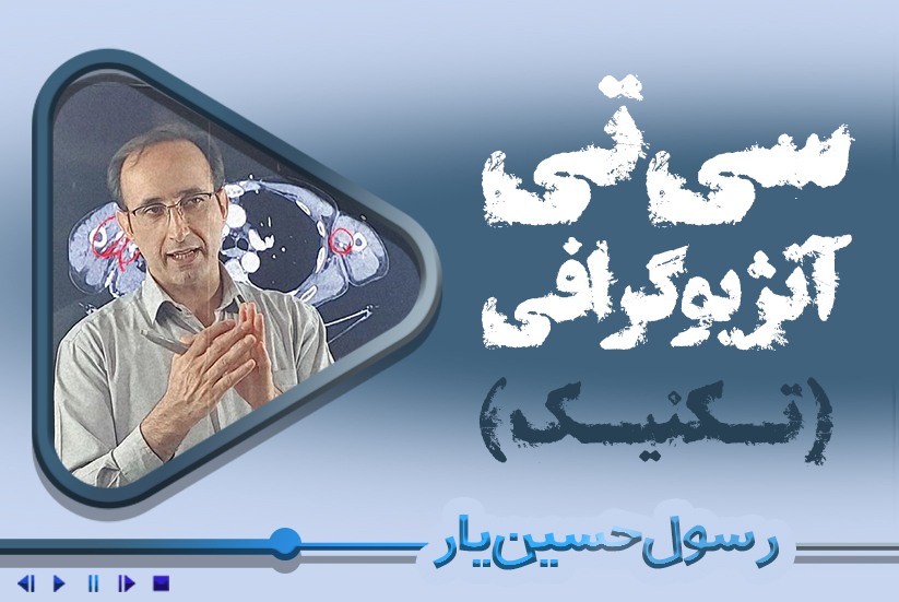 سی‌تی آنژیوگرافی (تکنیک)