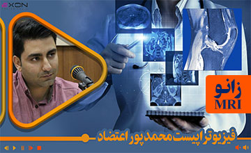 اصول تفسیر یافته های MRI مفصل زانو